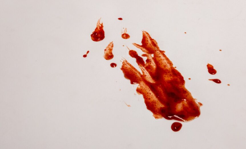 A close-up view shows a blood splatter on a clean, white surface. Small splatters are around the large one.